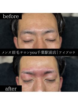 ユー 千葉駅前店(you)/ビフォ－アフター写真