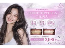 ピュアティス(PURETETH)