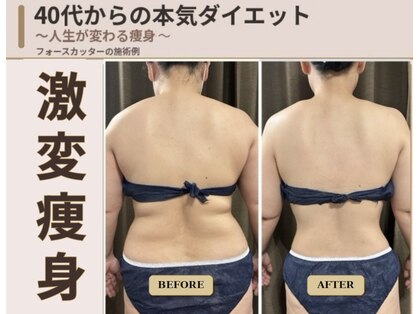 ミント(Mint)の写真