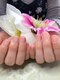 ミオン(mion)の写真/【深爪・巻き爪・ネイルのモチが悪い等…】お客様１人１人の本来の爪の美しさを♪何でもご相談下さい。