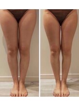 ルナグランデ(Luna grande.)/お肉を無くすと足長効果も！