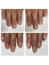 マニュコクーン(ManuCocoon)/爪育成　深爪　巻き爪　大阪市