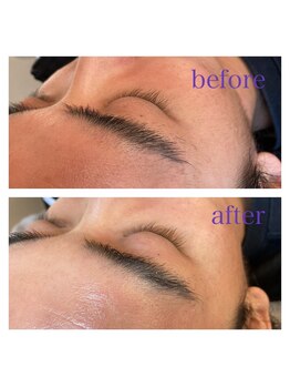 ルシアス(LUCIAS)/フェイスWaxトリートメント