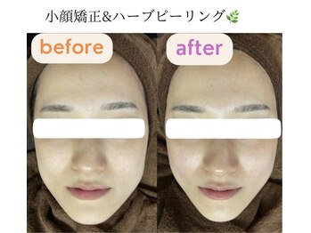 サクラ(SAKURA)/リフトアップ効果抜群♪