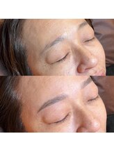 スリーノッツ(THREE KNOTS)/【ハリウッドブロウリフト】