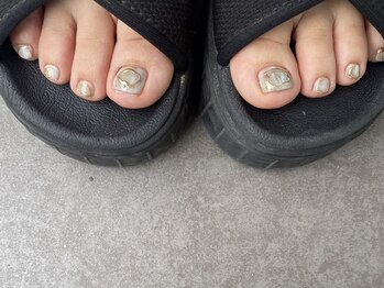 キト(KITO)/◆フットネイル