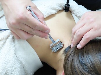 アルケル鍼灸整骨院/鍼灸/頭痛/めまい/自律神経/塩原