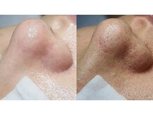 サロン ド アリーナ(Salon de Alina)の雰囲気（顔wax脱毛専門店。美肌リセット★ツルツルお顔毛穴洗浄）