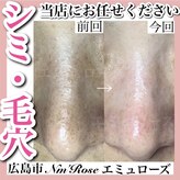 エミュローズ 段原店(Nm' Rose)