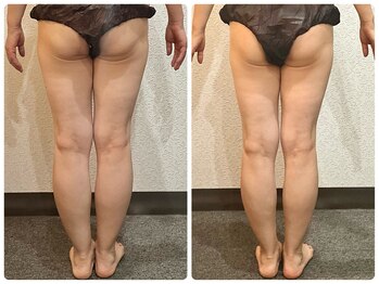 美容整体ウェリナ あま甚目寺院/小顔矯正/骨盤矯正/美脚サロン