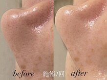 リスポアラボ(LIS PORE.LAB)/