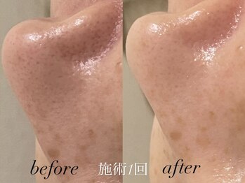 リスポアラボ(LIS PORE.LAB)/