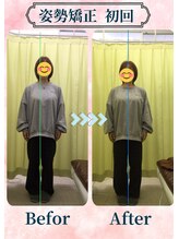 アミーゴ整体院/ビフォーアフター