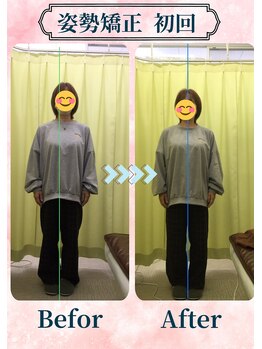 アミーゴ整体院/ビフォーアフター