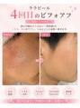 カエラ(KAELA)/1回で終わらせない、本気の肌管理
