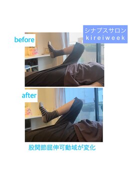 きれいウィーク 恵比寿/股関節施術before、after