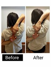 アース エンジェル整体院/ビフォアフ　肩甲骨はがし