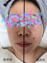 エヌ スタイル(N Style)/フェイシャル