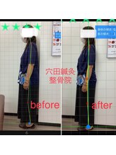 穴田鍼灸整骨院/整体・骨盤・ねこぜ・まき肩矯正