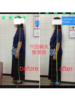 穴田鍼灸整骨院/整体・骨盤・ねこぜ・まき肩矯正