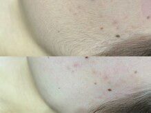 エルナチュール 上通(L nature)/フルフェイスWAX