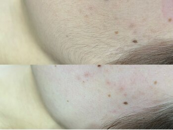 エルナチュール 上通(L nature)/フルフェイスWAX