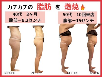 ルビー(RUBY)の写真