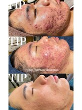 ニコサロン(nico salon)/