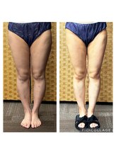 テラスアップ(Terrace UP)/【美脚へ】半身引き締めケア