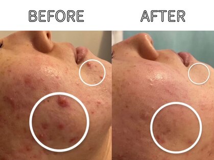 ベル 堀江(Belle)の写真