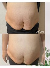 エノア(ENOA)/レッドショット1本