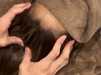 ベリーズ(BERRY'S)の写真/【吹田/岸辺】限界の眼精疲労・頭痛に！本格ドライヘッドスパで視界クリア◎自律神経の乱れにも◎