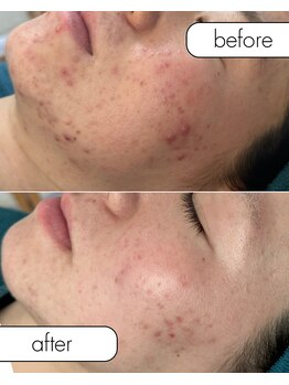 リノルーア(Linolua)/