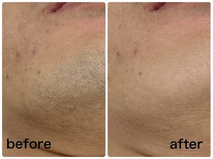 プルメリスタ 八千代緑が丘店の写真