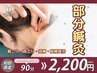 《鍼灸メニュー》部分鍼灸(肩こり・首こり・頭痛・眼精疲労)　