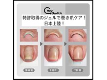 アンバー(AMBER)の雰囲気（巻き爪だからっておしゃれを諦めたくない巻き爪専用フットジェル）