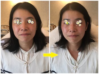 シベル(Si Belles)/40代前半/1回の結果