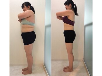 イーストレッチジム 大阪心斎橋店(E-STRETCH GYM)/ビフォーアフター