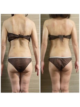 エムズ ビューティー サロン(M's Beauty Salon)/ビフォーアフター