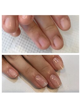 リーフ(Leaf)/ジェルで自爪育成