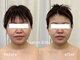 サロンディト(ditto)の写真