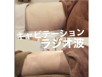 トータルエステティック ジョワイユ(JOYEUX)の写真