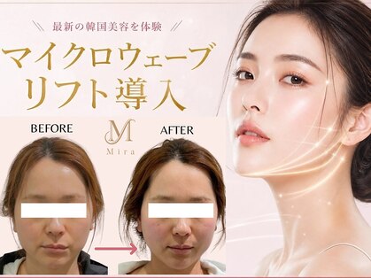 ミラ 札幌店(Mira)の写真