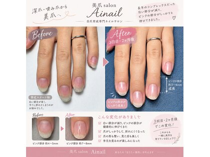 アイネイル(Ainail)の写真