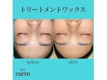 アクト クロ(ACT curro)/【フェイシャル】施術例