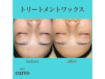 アクト クロ(ACT curro)/【フェイシャル】施術例