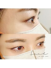 フィール(feel)/メーテルロット