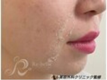 リン 大村本店(Rin)/結果重視です★