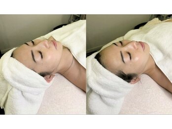 リュミエール デスポワール(Lumiere d'espoir)/ララピール