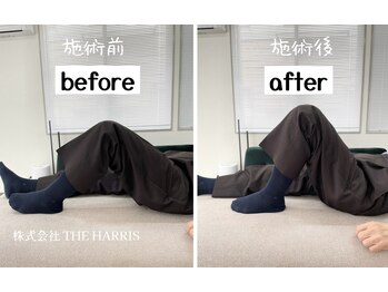 大館整体スタジオ/膝の施術ビフォーアフター